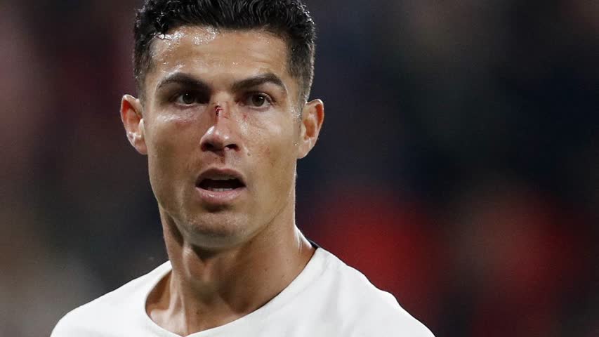 Фото - Роналду разбили лицо в матче Лиги наций